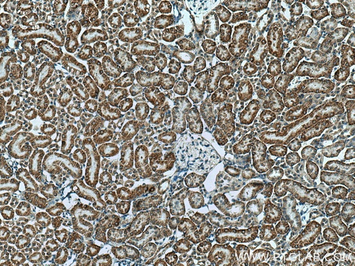 [14644-1-AP-150UL] RDH10 Polyclonal antibody