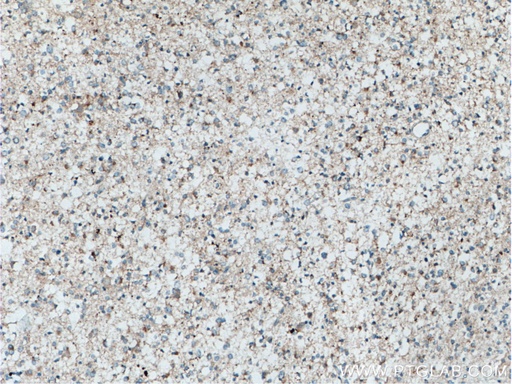 [14649-1-AP-150UL] POSH Polyclonal antibody
