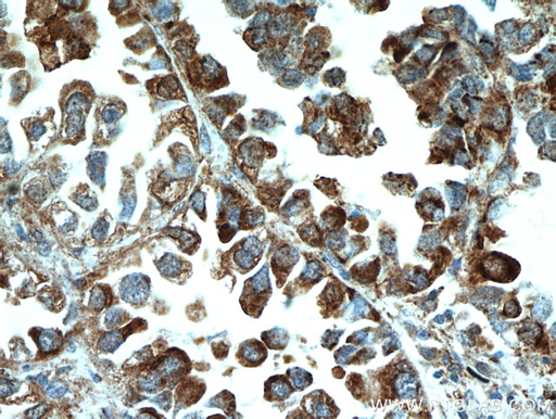 [14650-1-AP-20UL] MPP3 Polyclonal antibody