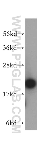 [14652-1-AP-150UL] ARPC3 Polyclonal antibody