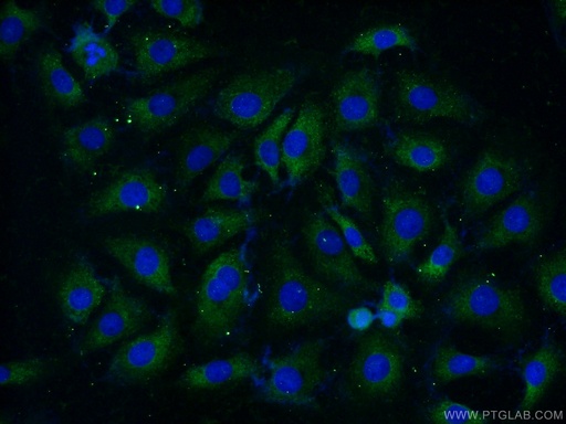 [14660-1-AP-20UL] RPL37A Polyclonal antibody
