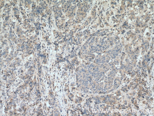 [14661-1-AP-150UL] PHLDA2 Polyclonal antibody