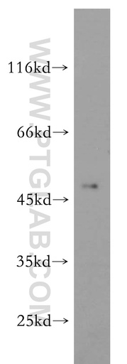 [14666-1-AP-150UL] ELK4 Polyclonal antibody