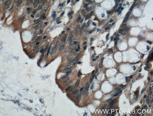 [14674-1-AP-20UL] ADHFE1 Polyclonal antibody