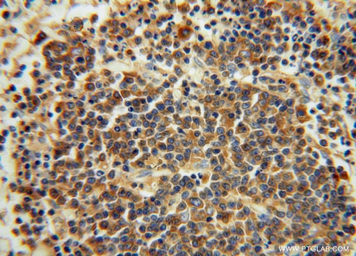 [14678-1-AP-20UL] IgG Kappa Light Chain Polyclonal antibody