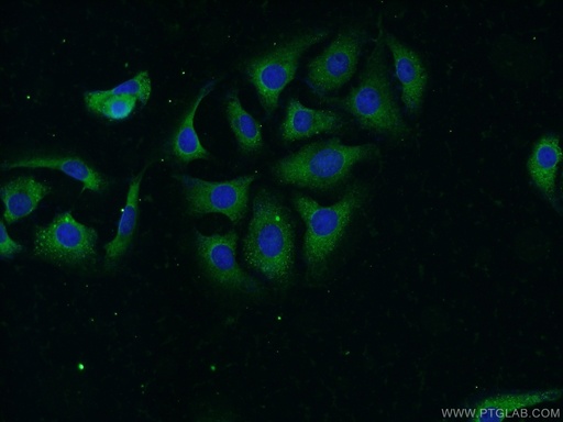 [14683-1-AP-150UL] NBAS Polyclonal antibody