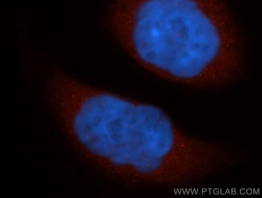 [14692-1-AP-20UL] THEM4 Polyclonal antibody
