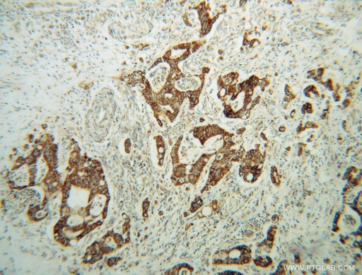 [14694-1-AP-150UL] AMN1 Polyclonal antibody