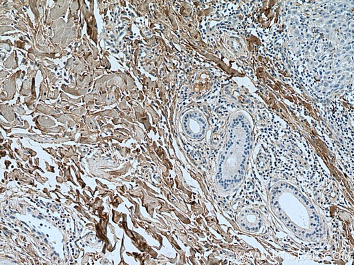 [14695-1-AP-150UL] Collagen Type I Polyclonal antibody