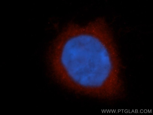 [14697-1-AP-150UL] KCNAB1 Polyclonal antibody