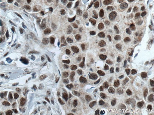 [14699-1-AP-20UL] ATF7IP Polyclonal antibody