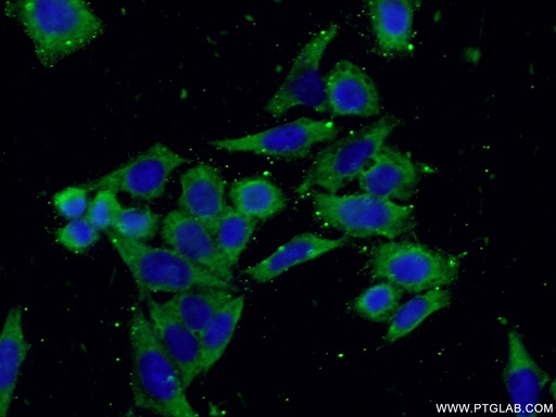 [14701-1-AP-20UL] RPL19 Polyclonal antibody