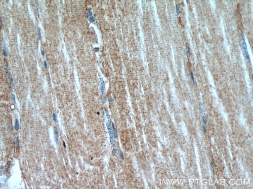 [14702-1-AP-150UL] MAP4K3 Polyclonal antibody