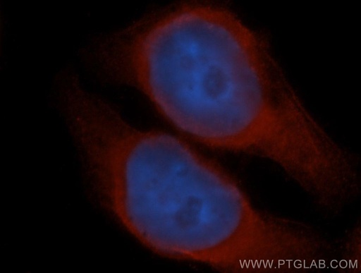 [14706-1-AP-20UL] UBXD1 Polyclonal antibody