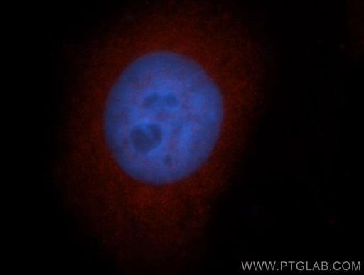 [14711-1-AP-20UL] MGEA5 Polyclonal antibody