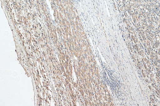 [14713-1-AP-150UL] PEX19 Polyclonal antibody