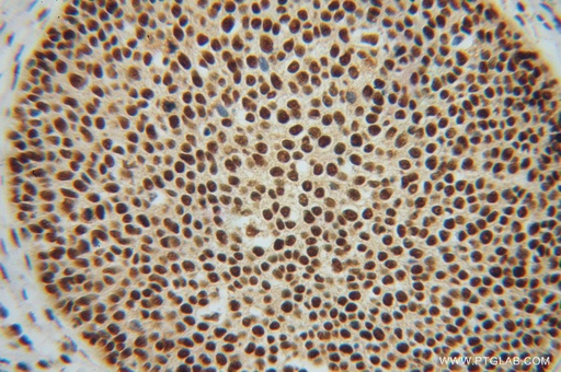 [14714-1-AP-150UL] NF45 Polyclonal antibody