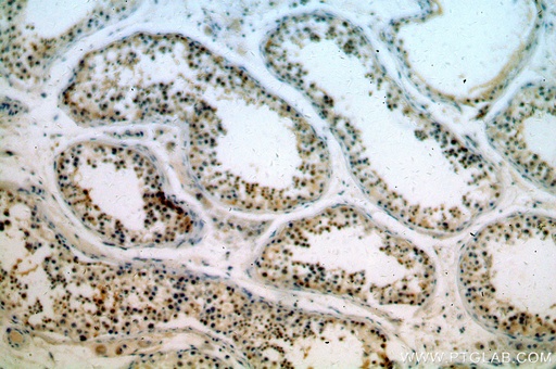 [14716-1-AP-150UL] KLF6 Polyclonal antibody