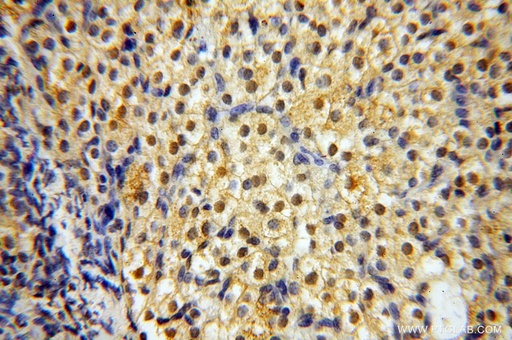 [14717-1-AP-20UL] CNBP Polyclonal antibody