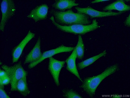 [14719-1-AP-20UL] PHGDH Polyclonal antibody