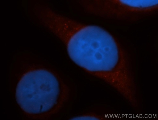 [14722-1-AP-150UL] DAPP1 Polyclonal antibody