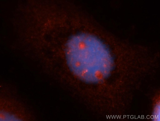 [14726-1-AP-150UL] SPAG5 Polyclonal antibody