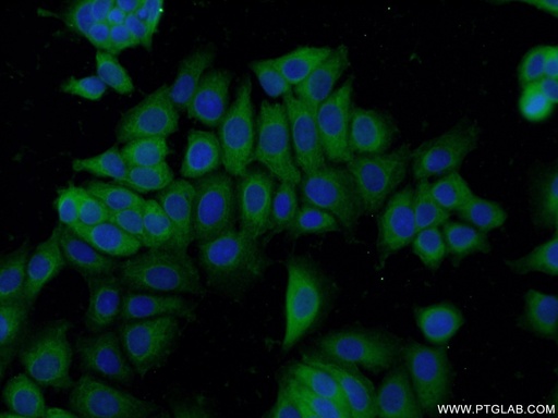 [14732-1-AP-20UL] hD53; TPD52L1 Polyclonal antibody