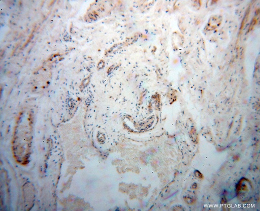 [14738-1-AP-150UL] DEFB1 Polyclonal antibody