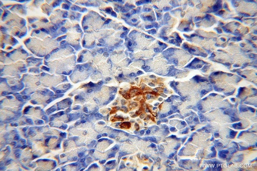 [14740-1-AP-20UL] CDK5RAP1 Polyclonal antibody