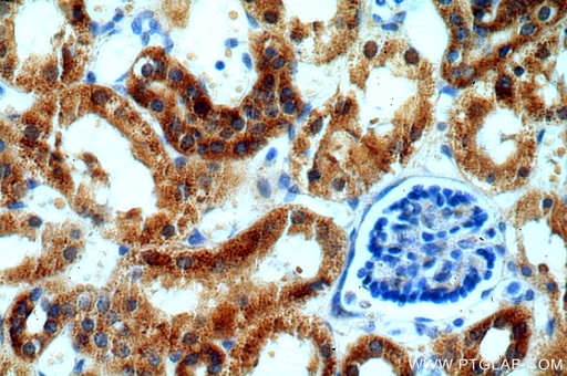 [14741-1-AP-150UL] IVNS1ABP Polyclonal antibody