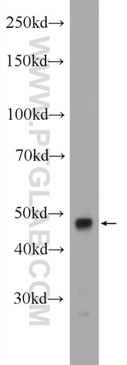 [14746-1-AP-150UL] CLP1 Polyclonal antibody