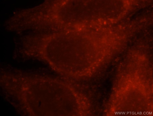 [14749-1-AP-150UL] CORO1C Polyclonal antibody