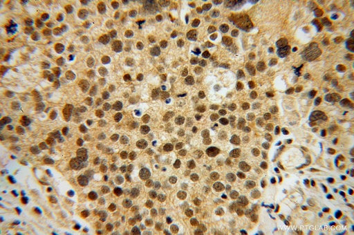[14751-1-AP-150UL] OSBPL2 Polyclonal antibody