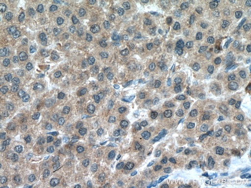 [14752-1-AP-150UL] PSMC5 Polyclonal antibody