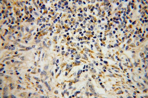 [14753-1-AP-20UL] SEC11A Polyclonal antibody