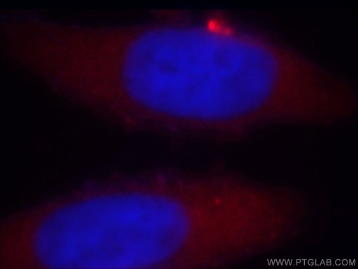 [14773-1-AP-20UL] TARS Polyclonal antibody