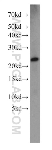 [14777-1-AP-150UL] Dermatopontin Polyclonal antibody