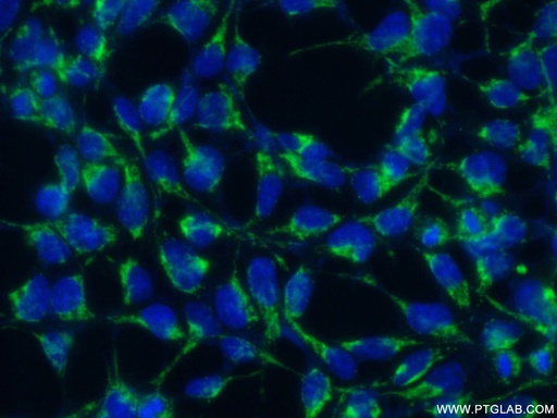 [14780-1-AP-20UL] ATP6V1B1 Polyclonal antibody