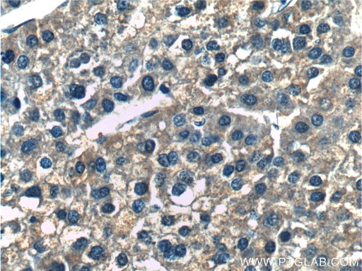 [14781-1-AP-150UL] ERLIN2 Polyclonal antibody