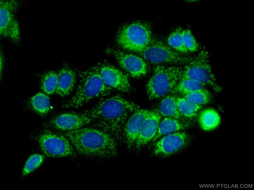 [14782-1-AP-150UL] SMTNL2 Polyclonal antibody