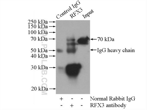 [14784-1-AP-150UL] RFX3 Polyclonal antibody