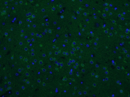 [14788-1-AP-20UL] CAMKV Polyclonal antibody