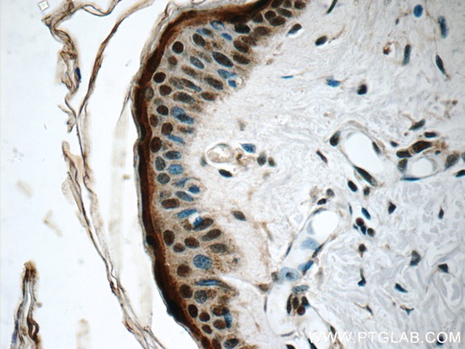 [14789-1-AP-20UL] SNRPD2 Polyclonal antibody