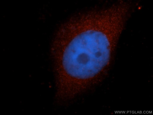 [14797-1-AP-20UL] HMBS Polyclonal antibody