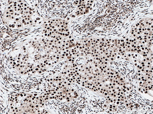 [14798-1-AP-20UL] DDX39B Polyclonal antibody