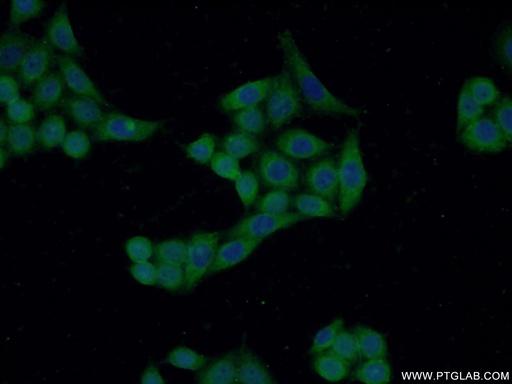 [14801-1-AP-20UL] CRIP2 Polyclonal antibody