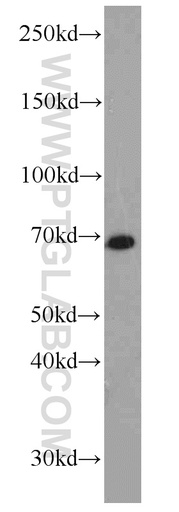 [14802-1-AP-150UL] NOL4 Polyclonal antibody