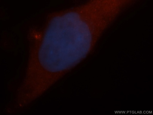 [14803-1-AP-150UL] ARD1A Polyclonal antibody