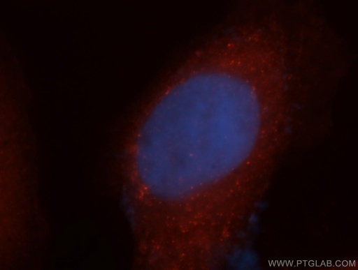 [14805-1-AP-150UL] EXOSC2 Polyclonal antibody