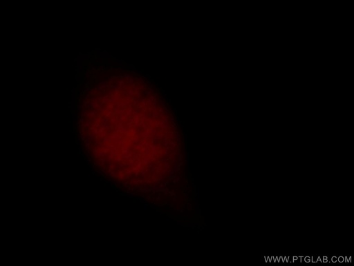 [14809-1-AP-20UL] OBFC2B Polyclonal antibody